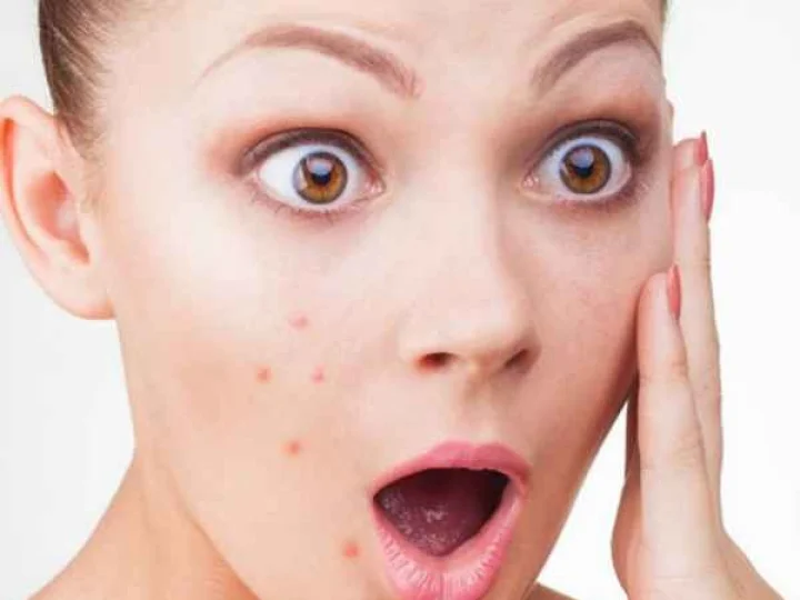 Skin Care Tips