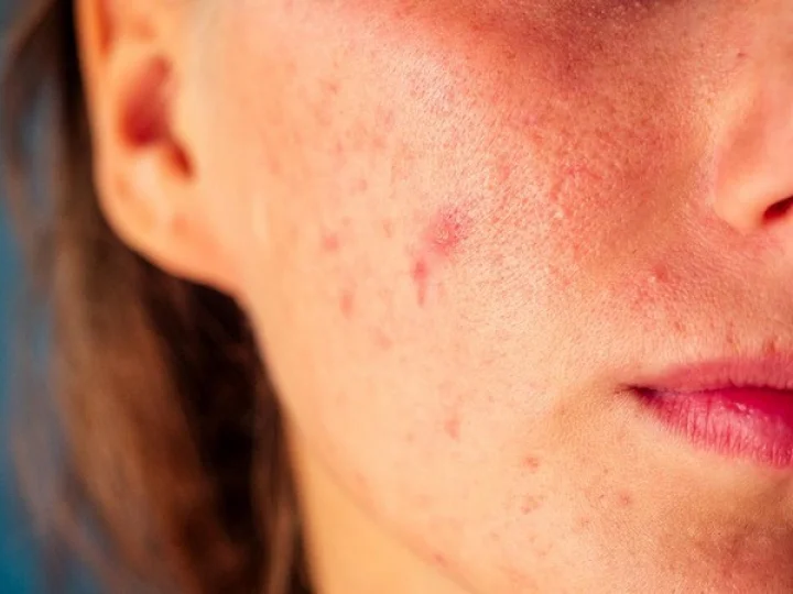 Beauty Health Tips