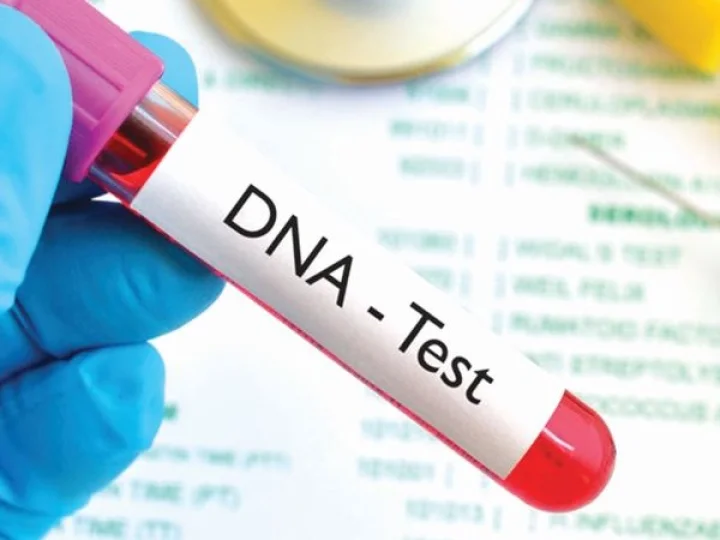 DNA Test