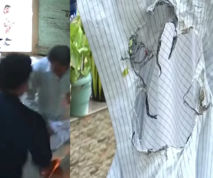 Mobile phone blast in pocket
