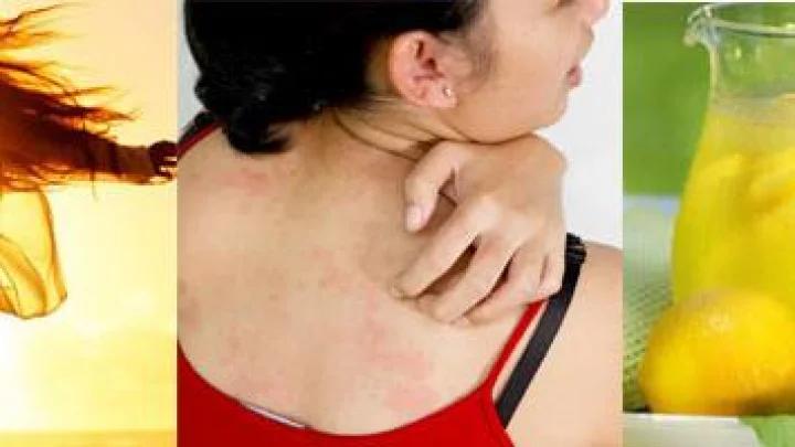 उन्हापासून बचाव करण्यासाठी हे करा...।