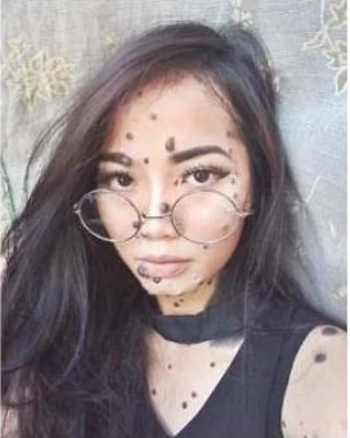 शरीरभर तीळ