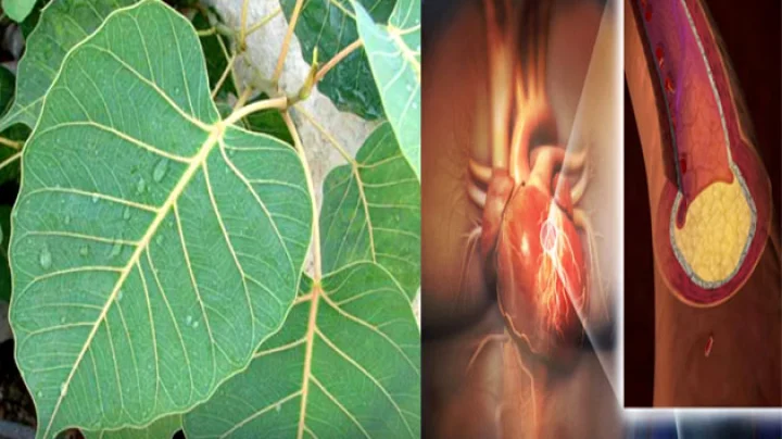 Heart Blockage Treatment Without Surgery