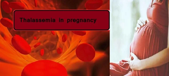 Thalassemia in pregnancy