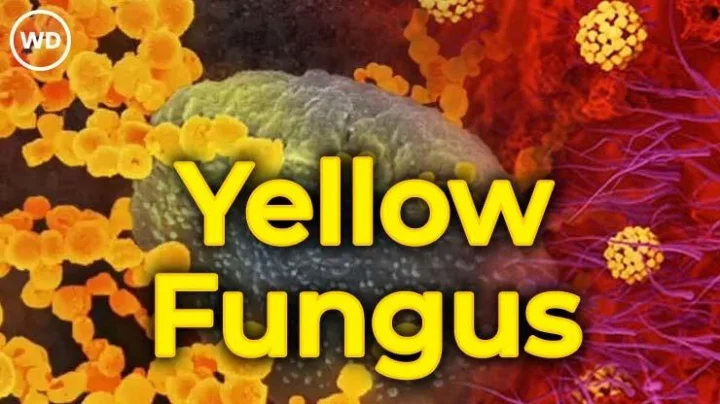 Yellow Fungus काय आहे?  'पिवळ्या बुरशी' चे लक्षणं, बचाव आणि खबरदारी