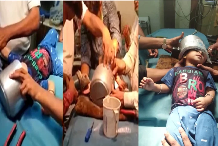Toddler With Head Stuck Inside Pressure Cooker Freed By Doctors In UP's Agra