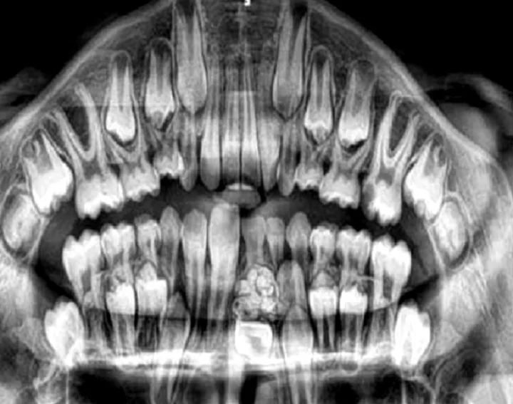 50 teeth