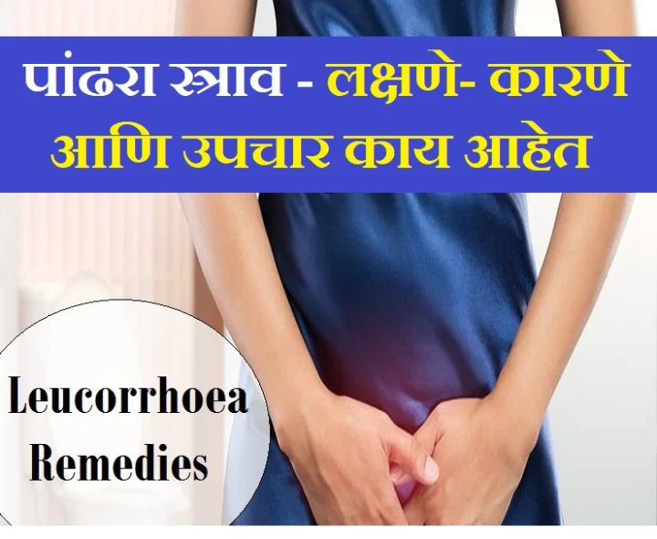 leucorrhoea
