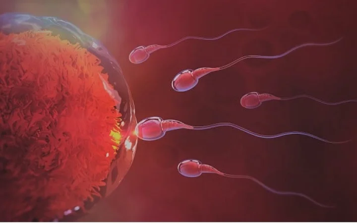 PCOS