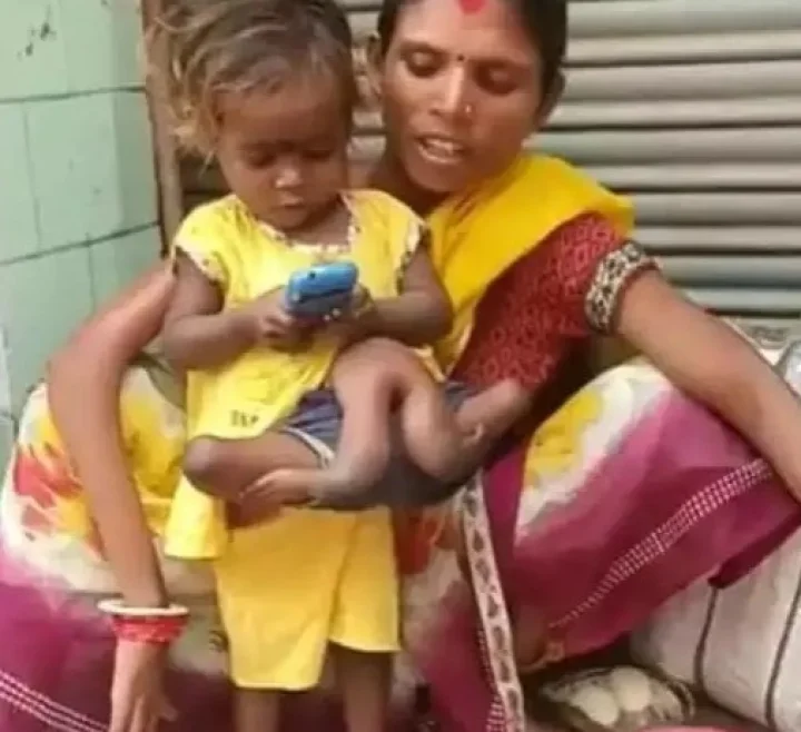 Family needs help for a girl with 4 arms and 4 legs 4 हात आणि 4 पाय असलेल्या मुलीसाठी कुटुंबाला मदतीची गरज