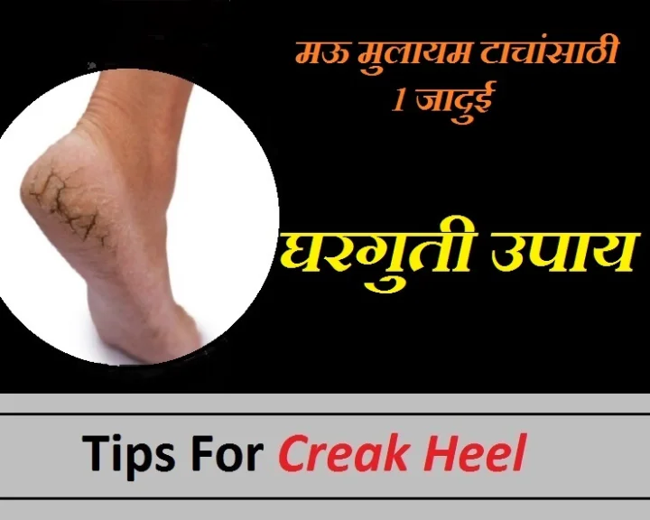 cracked heels