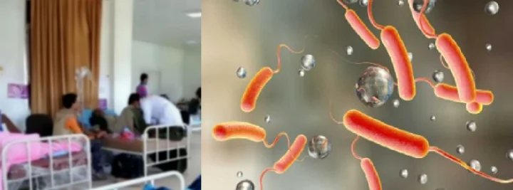 cholera