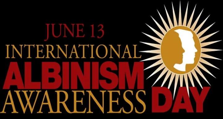 albinism org