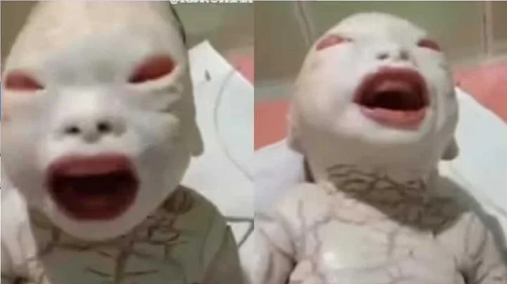 Alien Child Birth :  महिलेने दिला एलियन सदृश मुलाला जन्म