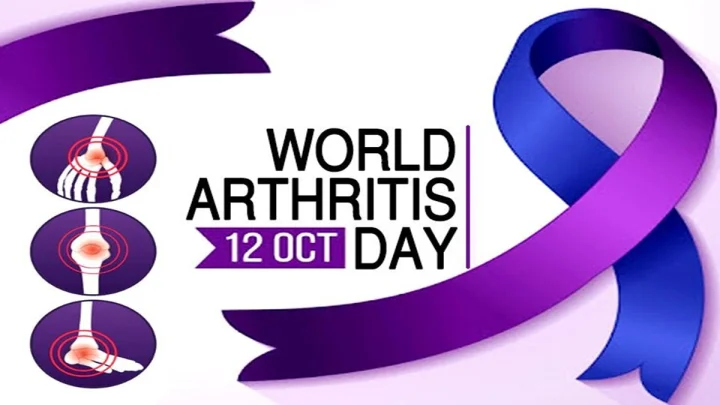 Arthritis