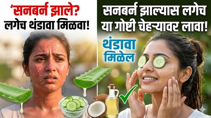 सनबर्न झाल्यास लगेच या गोष्टी चेहऱ्यावर लावा, थंडावा मिळेल