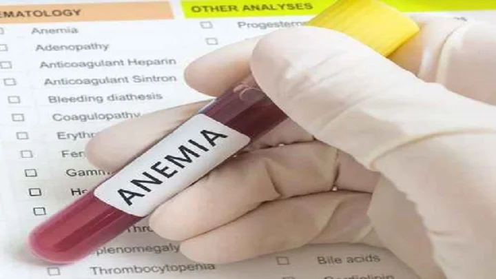 anemia