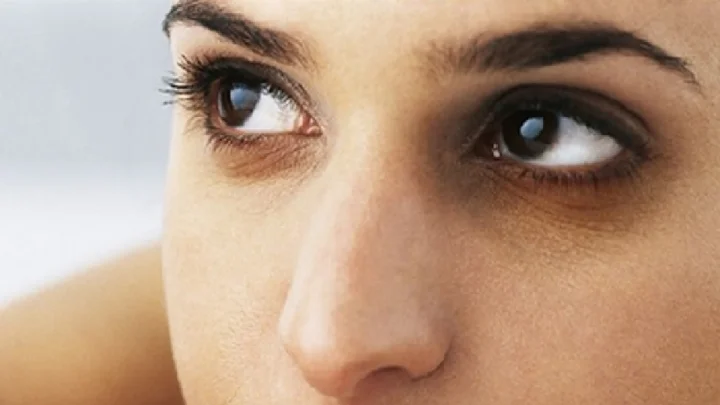How to reduce dark circles under the eyes