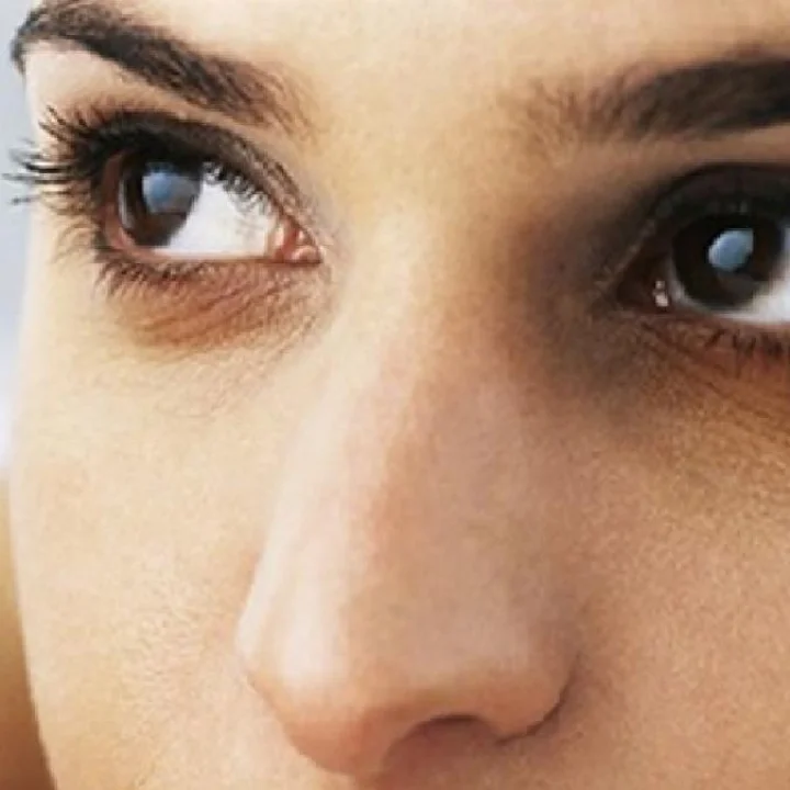 How to reduce dark circles under the eyes