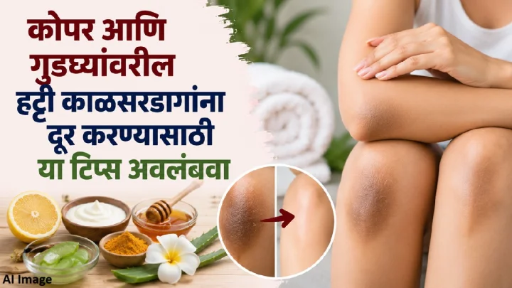 कोपर आणि गुडघे काळे पडले आहेत? काळसरपणा कमी करण्यासाठी करा हे उपाय करा