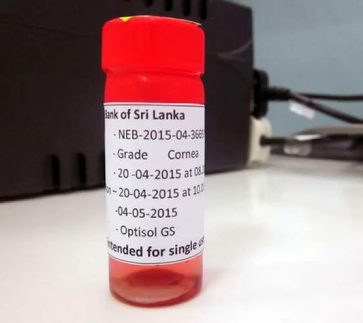 உலக நாடுகளுக்கு கண்பார்வை தரும் இலங்கை