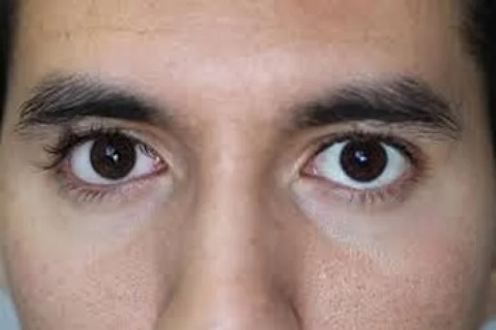 க‌ண் சோ‌ர்வு‌க்கு மரு‌ந்து