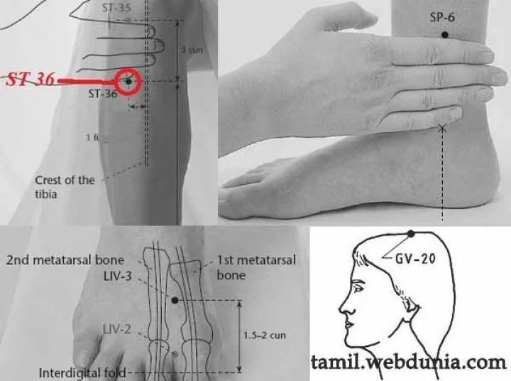 BP-யை குணமாக்கும் அக்குபங்க்சர்