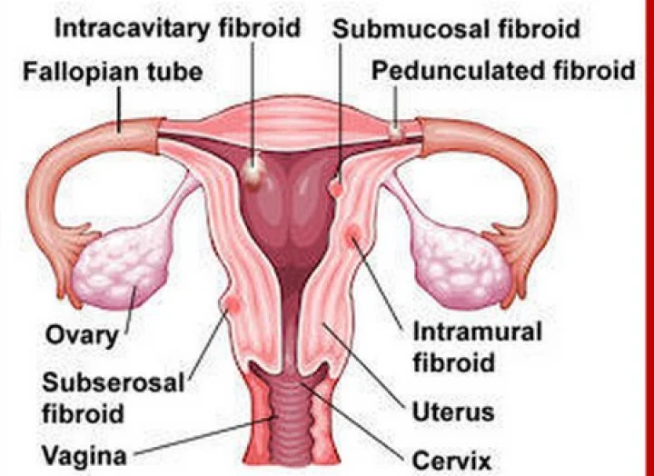IVF எனும் செயற்கை கருத்தரிப்பும் அக்குபஞ்சரும்!! (பகுதி 4)
