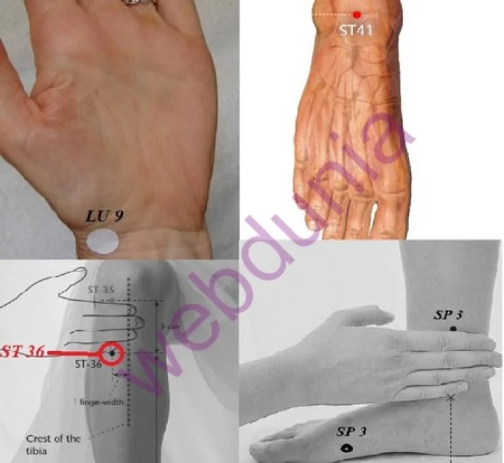 வெரிகோஸ் வெயின் எனும் நரம்பு சுருட்டு பிரச்சினைக்கு அக்குபங்க்சரில் தீர்வு!!