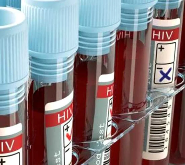 ஆச்சர்யம்! ஹெச்.ஐ.வி. பாதிக்கப்பட்ட குழந்தைகளுக்கு எய்ட்ஸ் இல்லை