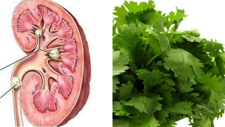 சிறுநீரகத்தை சுத்தம் செய்வதில் சிறப்பாக செயல்படும் கொத்தமல்லி