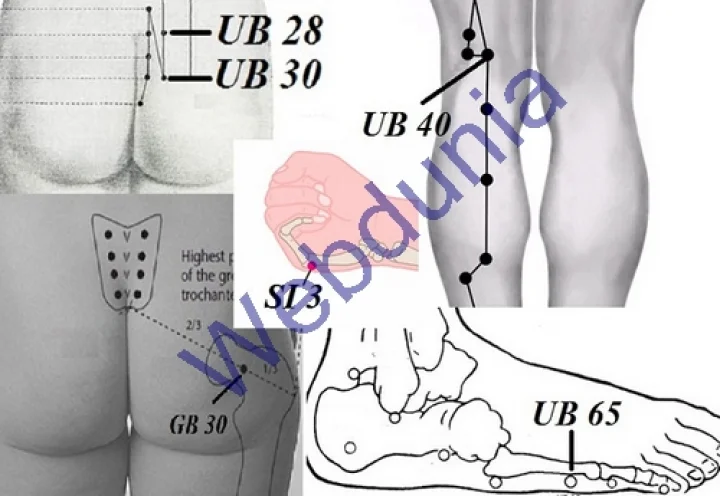 சயாடிக்கா (Sciatica) வலியை போக்கும் அக்குபஞ்சர் !!