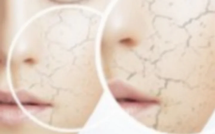 பனிக்காலத்தில் சருமம் வறட்சி ஏற்படுவதற்கான காரணங்கள்!