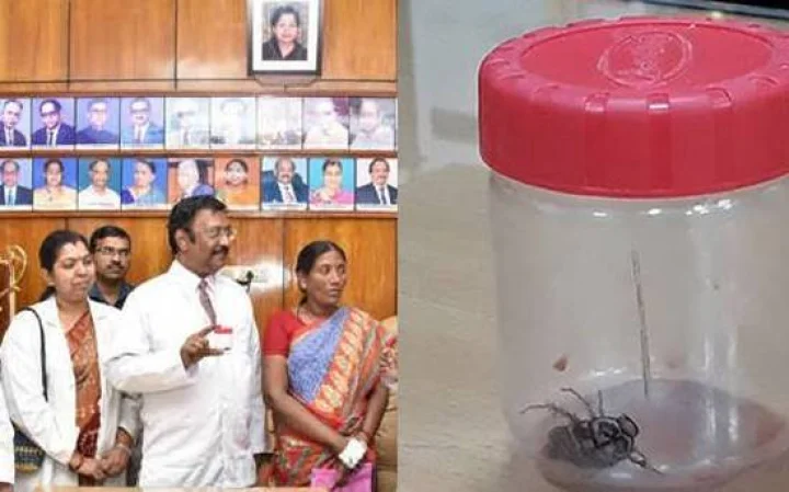 பெண்ணின் மூக்கு வழியாக மூளைக்கு சென்ற கரப்பான் பூச்சி