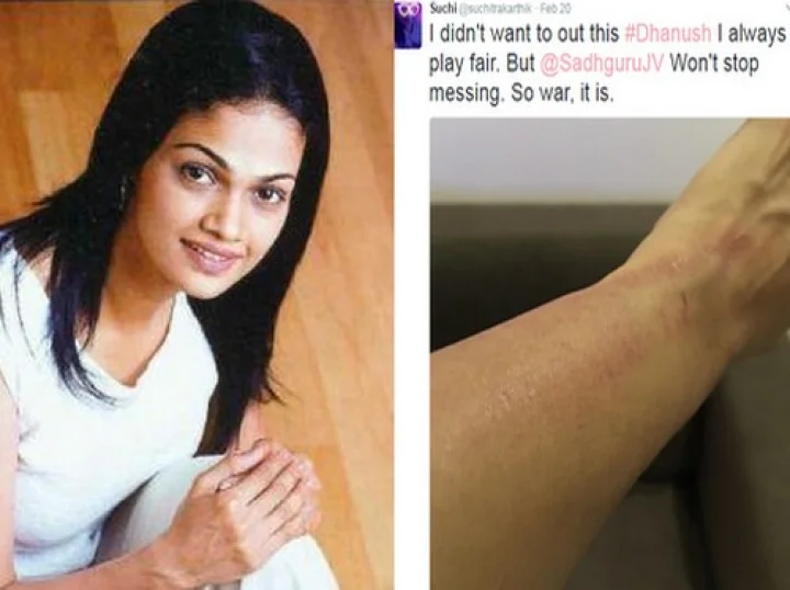 சுசித்ராவின் கையை பதம் பார்த்த தனுஷ் டீம் - நள்ளிரவு என்ன நடந்தது?