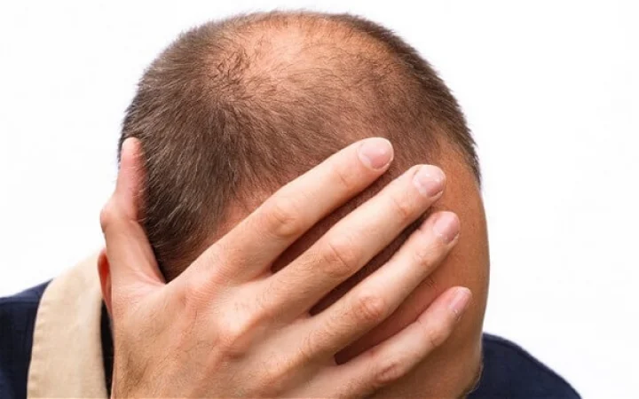 11 villages in Buldhana district in panic; People are going bald due to disease
