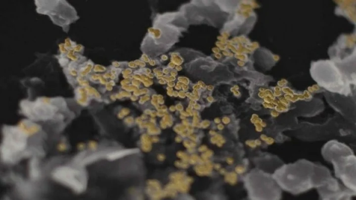 தங்கத்தை கக்கும் பேக்டீரியாவை பற்றி தெரியுமா??