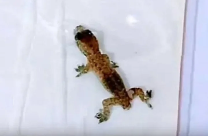 ஆணின் காதுக்குள் வாழ்ந்து வந்த பல்லி....