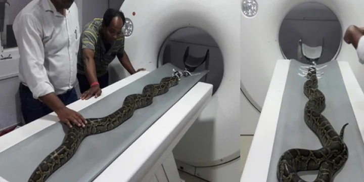 மலைப்பாம்புக்கு சிடி ஸ்கேன்...