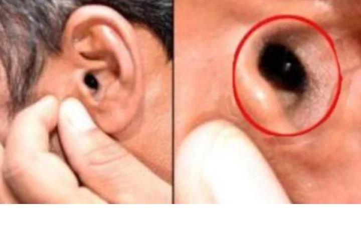 ear cancer