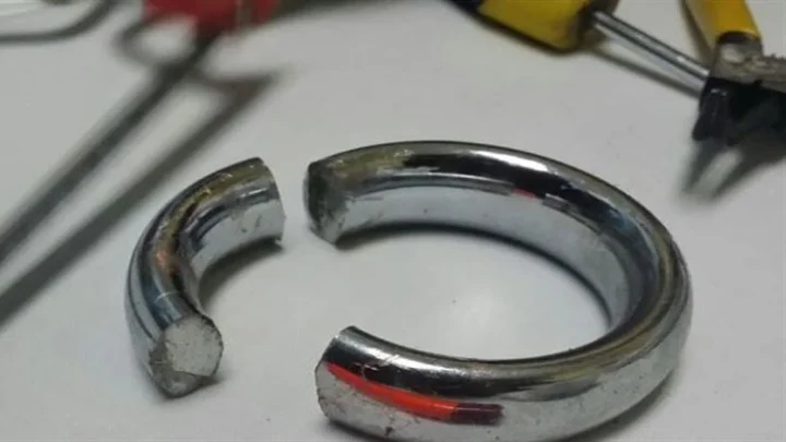 ஆணுறுப்பில் சிக்கிய வளையத்தை மீட்க ஆறு மணி நேரம் போராடிய டாக்டர்கள்