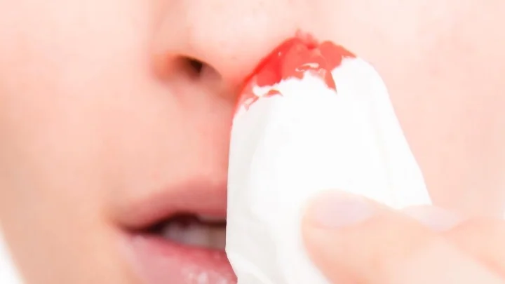 If the bleeding