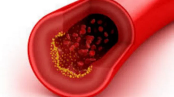 கொலஸ்ட்ராலை வேகமாக குறைக்க உதவும் உணவுகள் !!