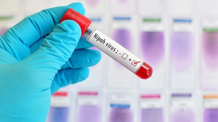 nipah virus