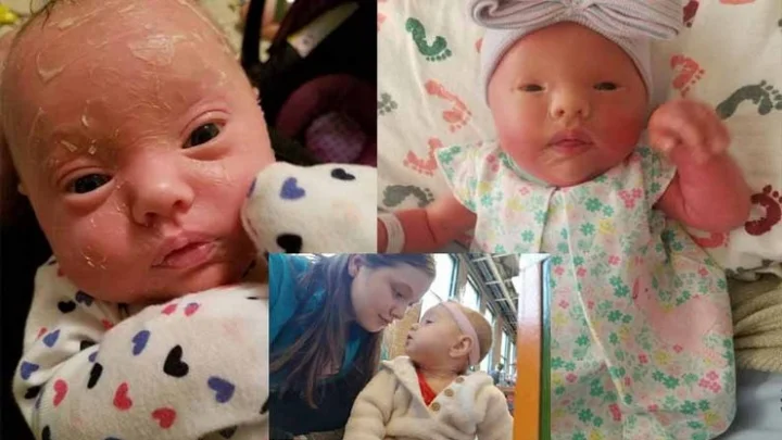 குழந்தைக்கு பிளீச்சிங் பவுடர் போட்டு குளிப்பாட்டும் தாய்