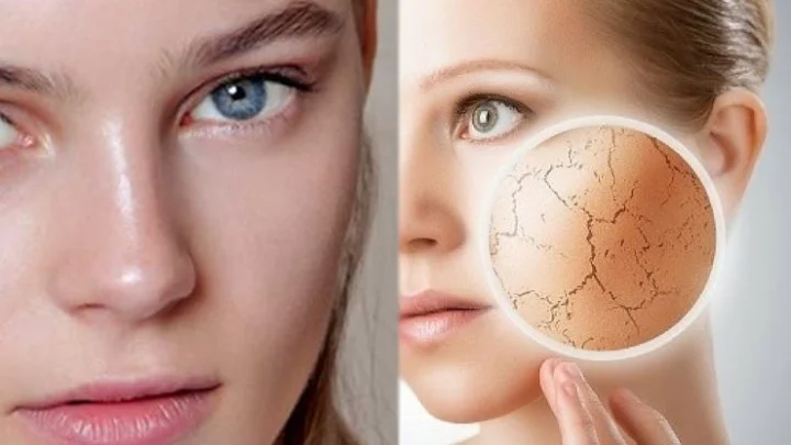 எண்ணெய் பசை மற்றும் வறண்ட சருமத்தை போக்க சில டிப்ஸ்...!