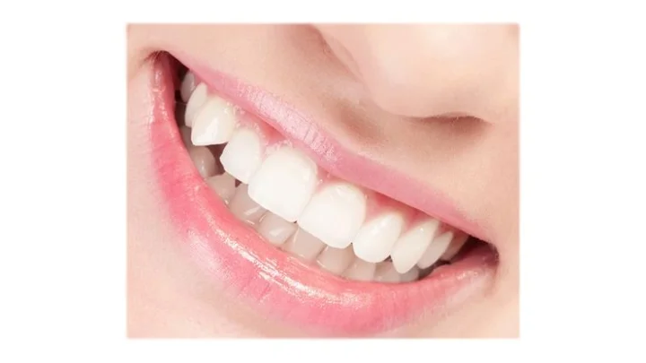 இயற்கையான முறையில் பற்களை வெண்மையாக்கும் குறிப்புகள்...!