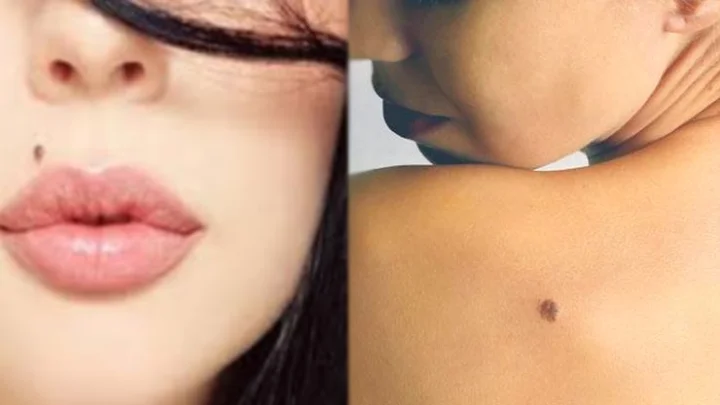 Female Mole Meaning