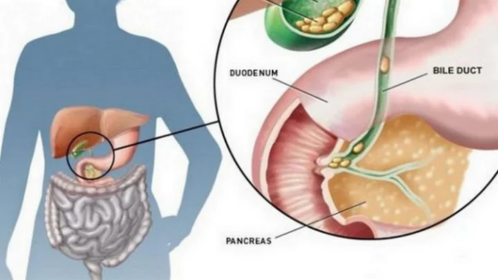 பித்தப்பை