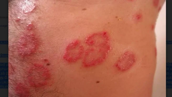 ஸ்டிராய்டு 